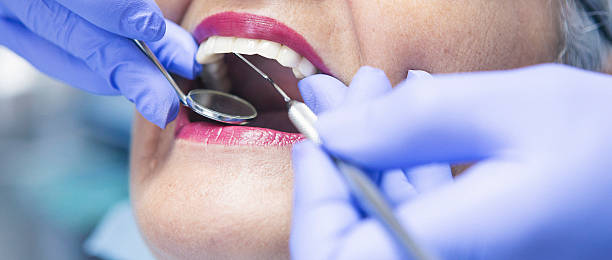 Best Dental Abscess Treatment in Rockville, IN